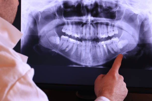 Best Tooth Pain Emergency Relief  in Webberville, MI