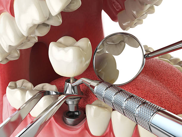 Best Emergency Dental Services Near Me  in Webberville, MI